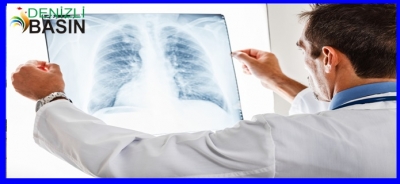 AKCİĞER KANSERİNDE YENİ TEDAVİLER UMUT VERİYOR!