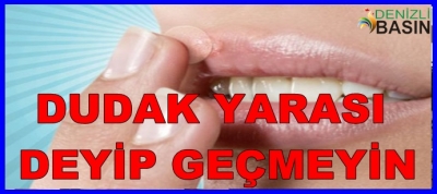 DUDAK YARASI DEYİP GEÇMEYİN!