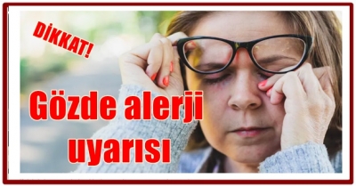 Gözde Alerji Uyarısı 