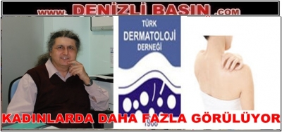Kadınlarda Daha Fazla Görülüyor