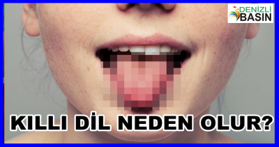 Kıllı Dil Neden Olur?