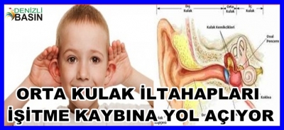 Orta Kulak İltihapları, İşitme Kaybına Yol Açabiliyor