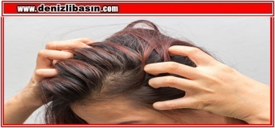 Saç, Sakal Ve Kaş Koparmak Bir Hastalık!